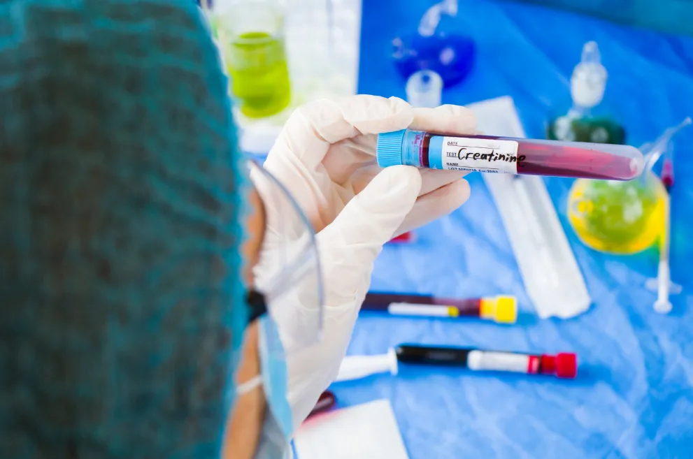 Doctor holding blood vial with word Creatinine on label