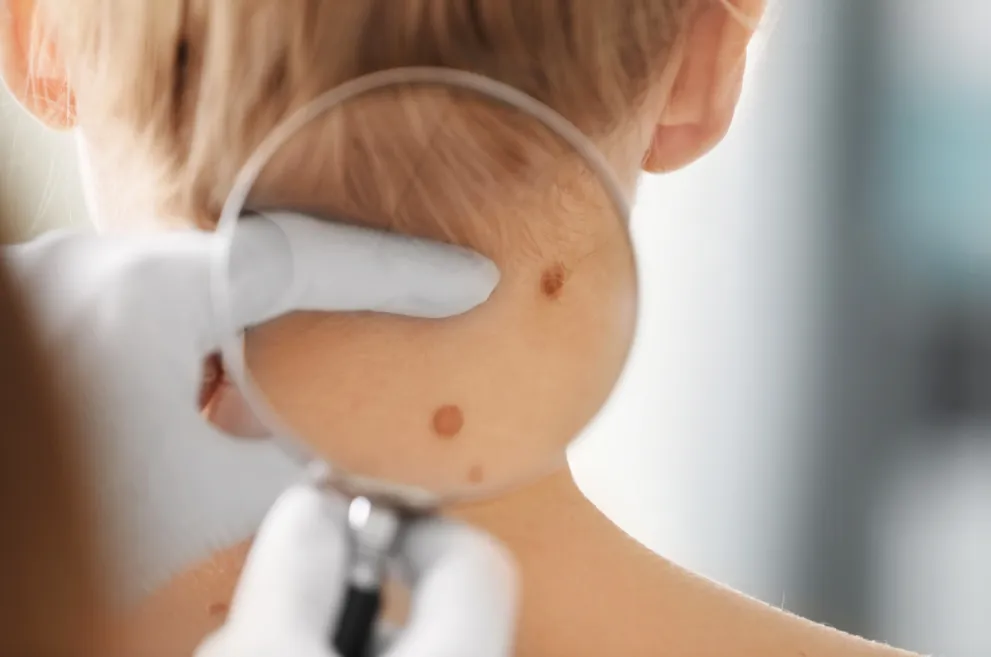 Doctor examining moles on woman's neck