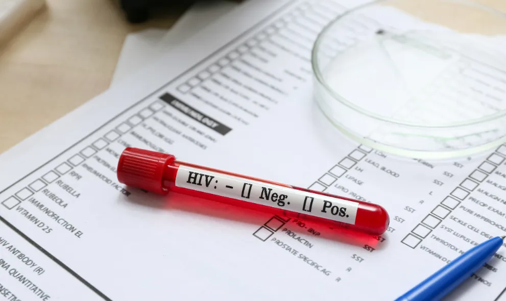 HIV blood test tube on laboratory report