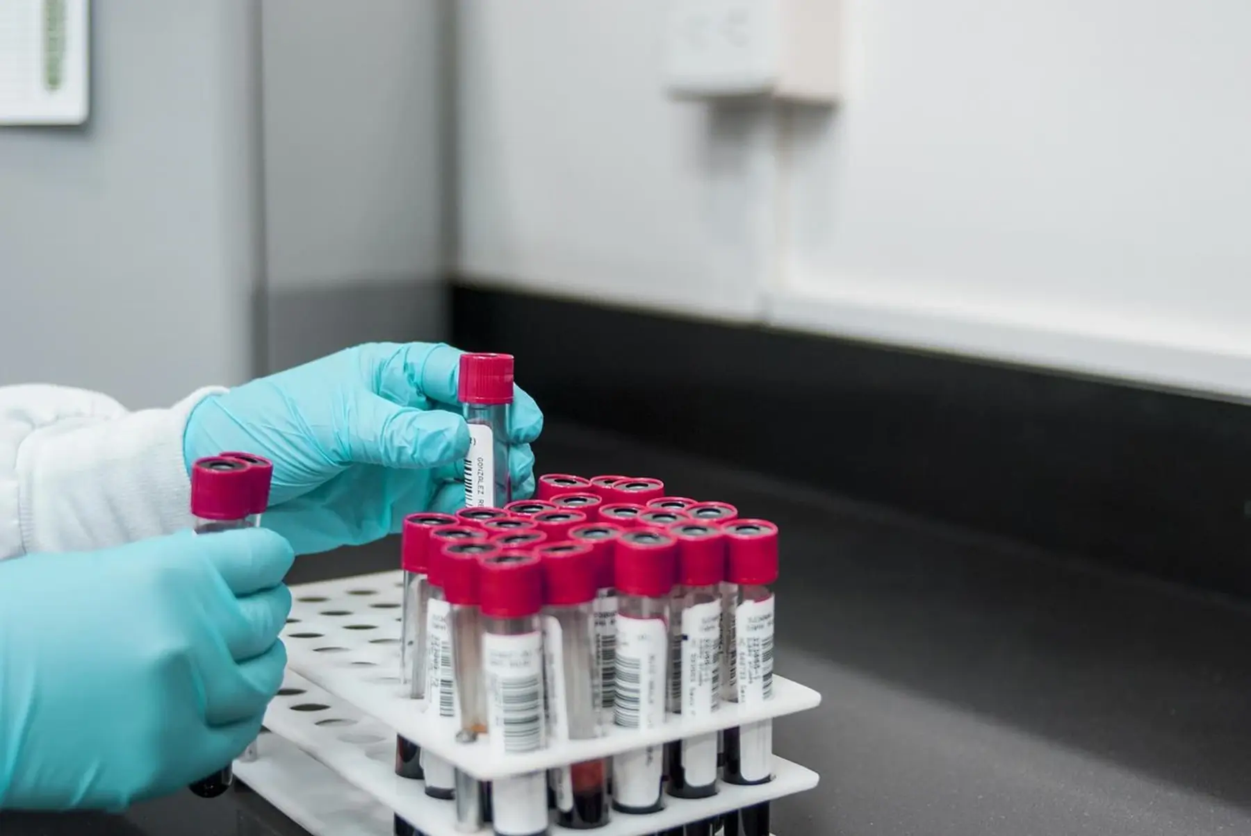 Lab technician handling blood samples