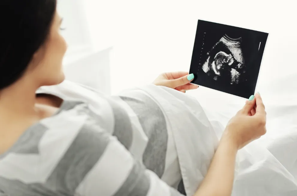 Pregnant woman holding ultrasound image