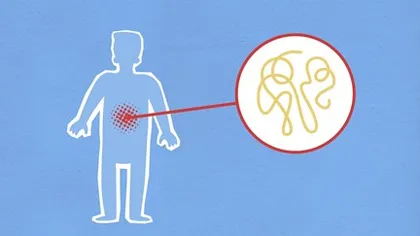 Cartoon image of man with focus on intestines