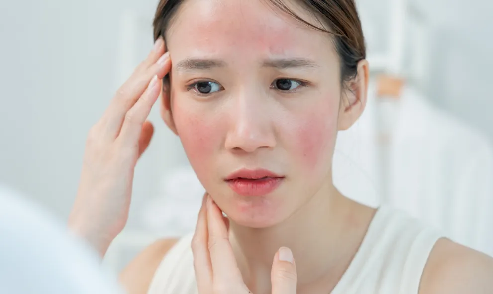 Woman examining rosacea on her face