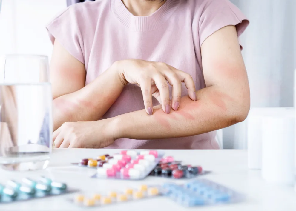 Woman having an allergic reaction to medication