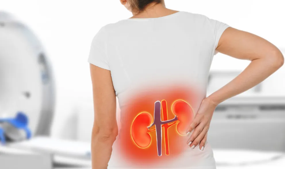 Woman with kidney pain conceptual image