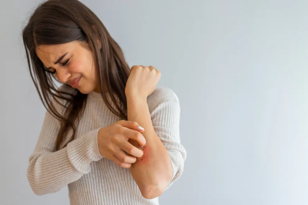 Young woman with psoriasis scratching arm